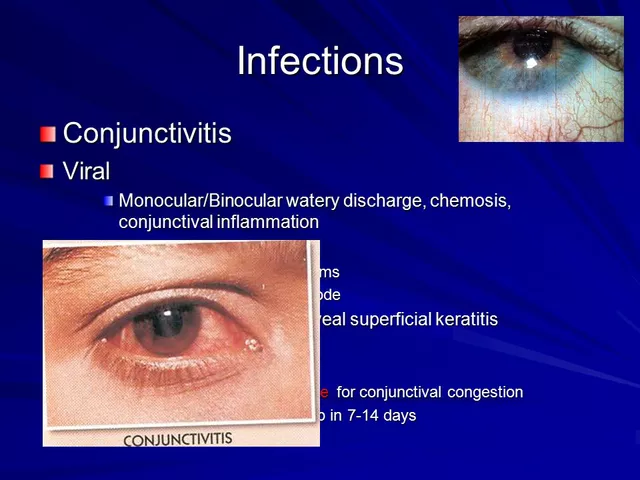 The Importance of Loteprednol in Ocular Inflammation Treatment