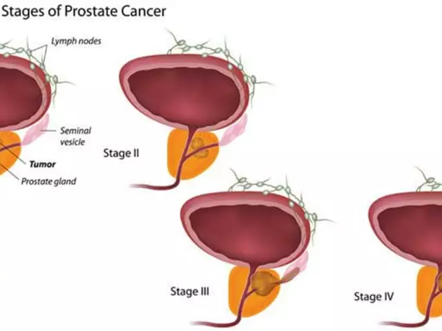 Flutamide and Fertility: What Prostate Cancer Patients Should Know