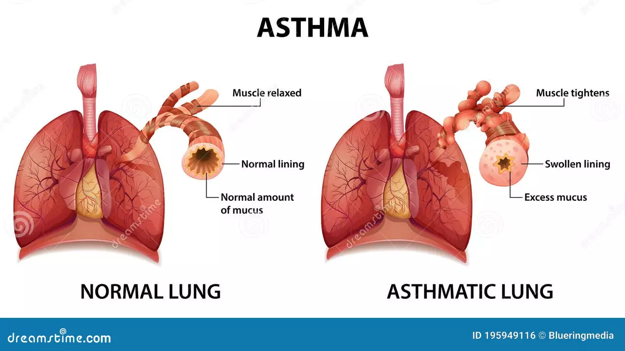 The Importance of Regular Checkups for Early Detection of Lung Inflammation